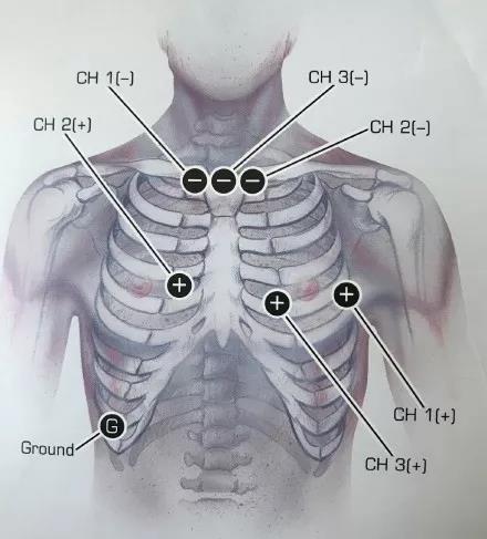 智能医疗|智能硬件